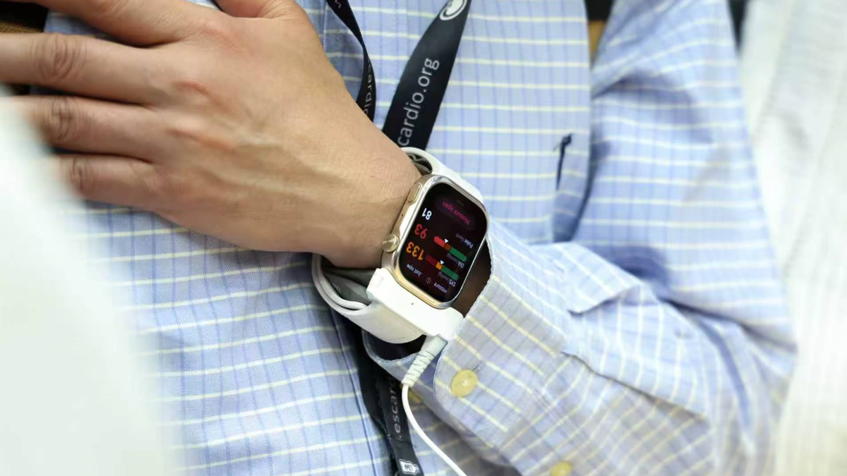 Close-up of the Huawei Watch D3