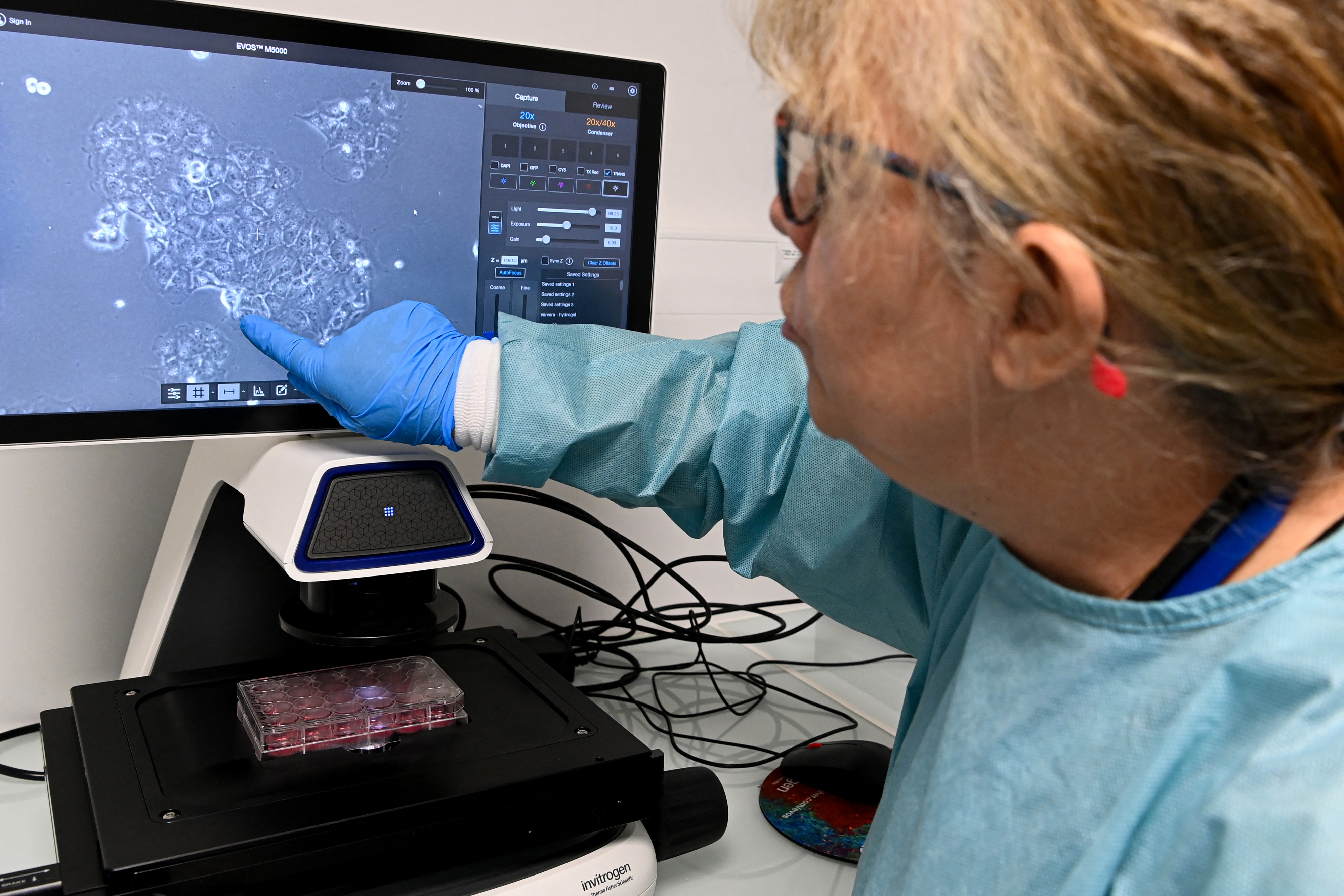 Clinical trial data showing promise in pancreatic cancer treatment