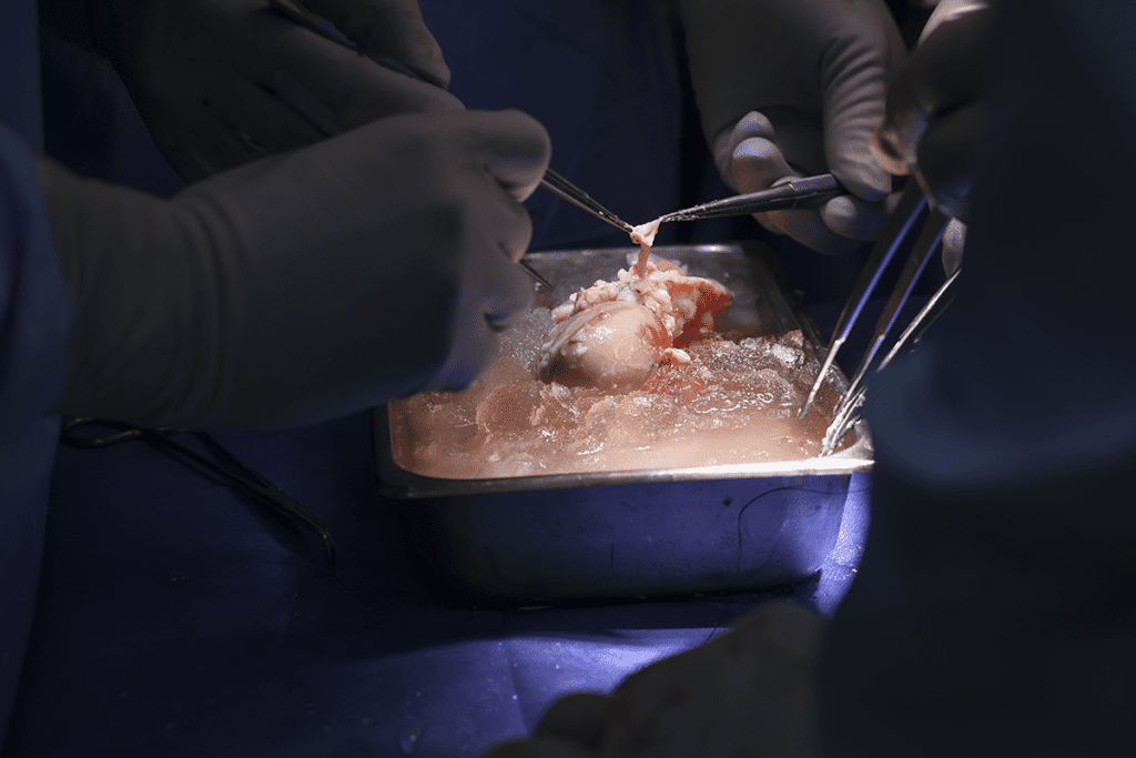 Image showing the eGenesis study on pig kidneys extending human lifespan