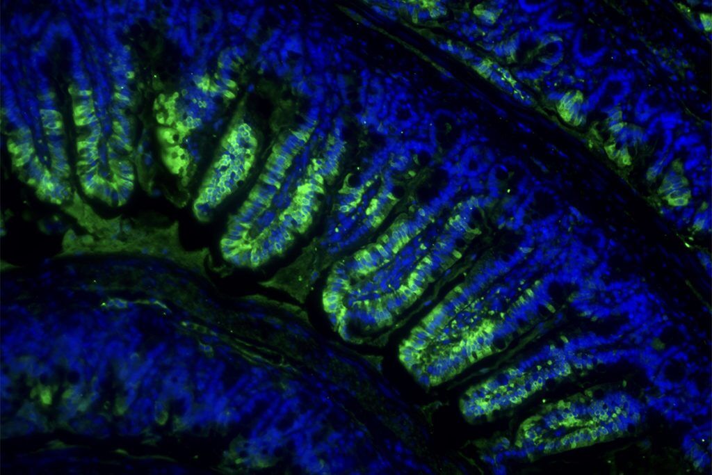 Immunostaining for the Lac-Phe biosynthetic enzyme CNDP2 in the gut showing enterocyte expression