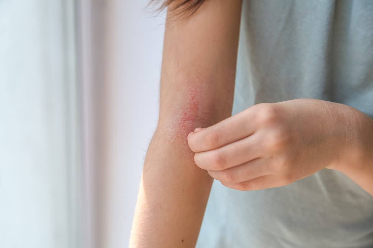 Research image explaining the connectivity between chronic skin conditions and the brain-gut-skin axis