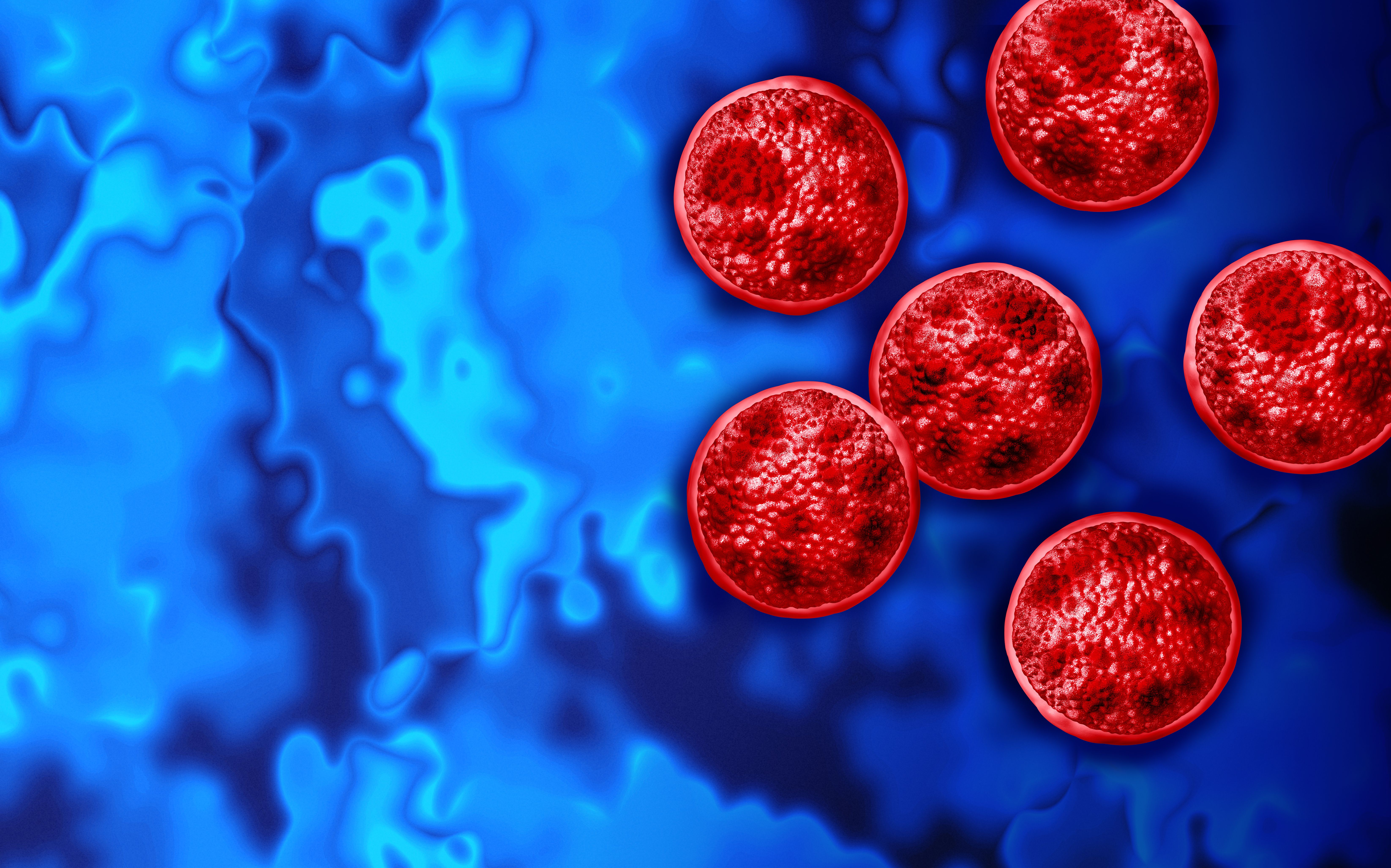 CDC health alert on cyclosporiasis outbreak response