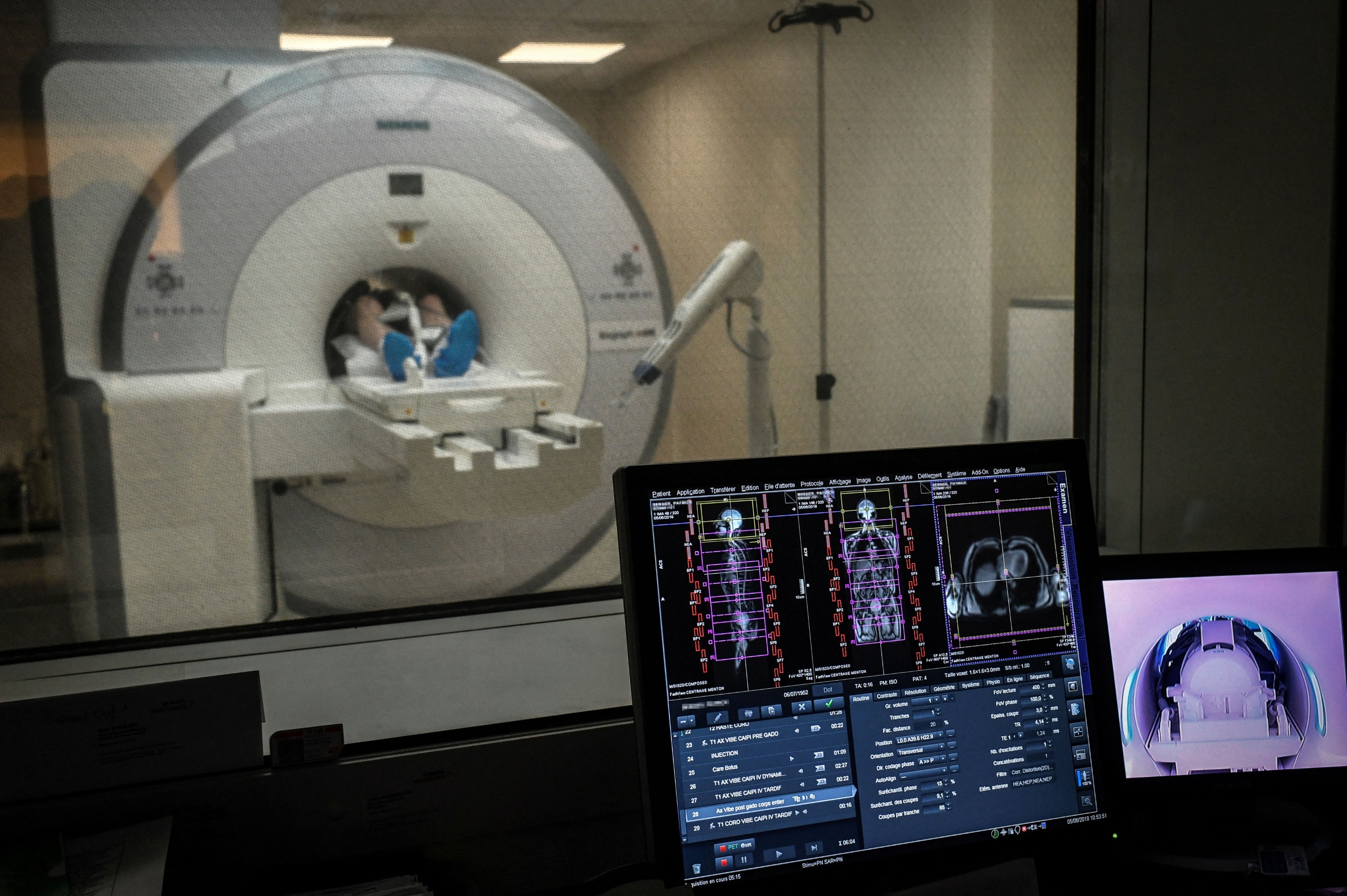 AI cancer detection visualization