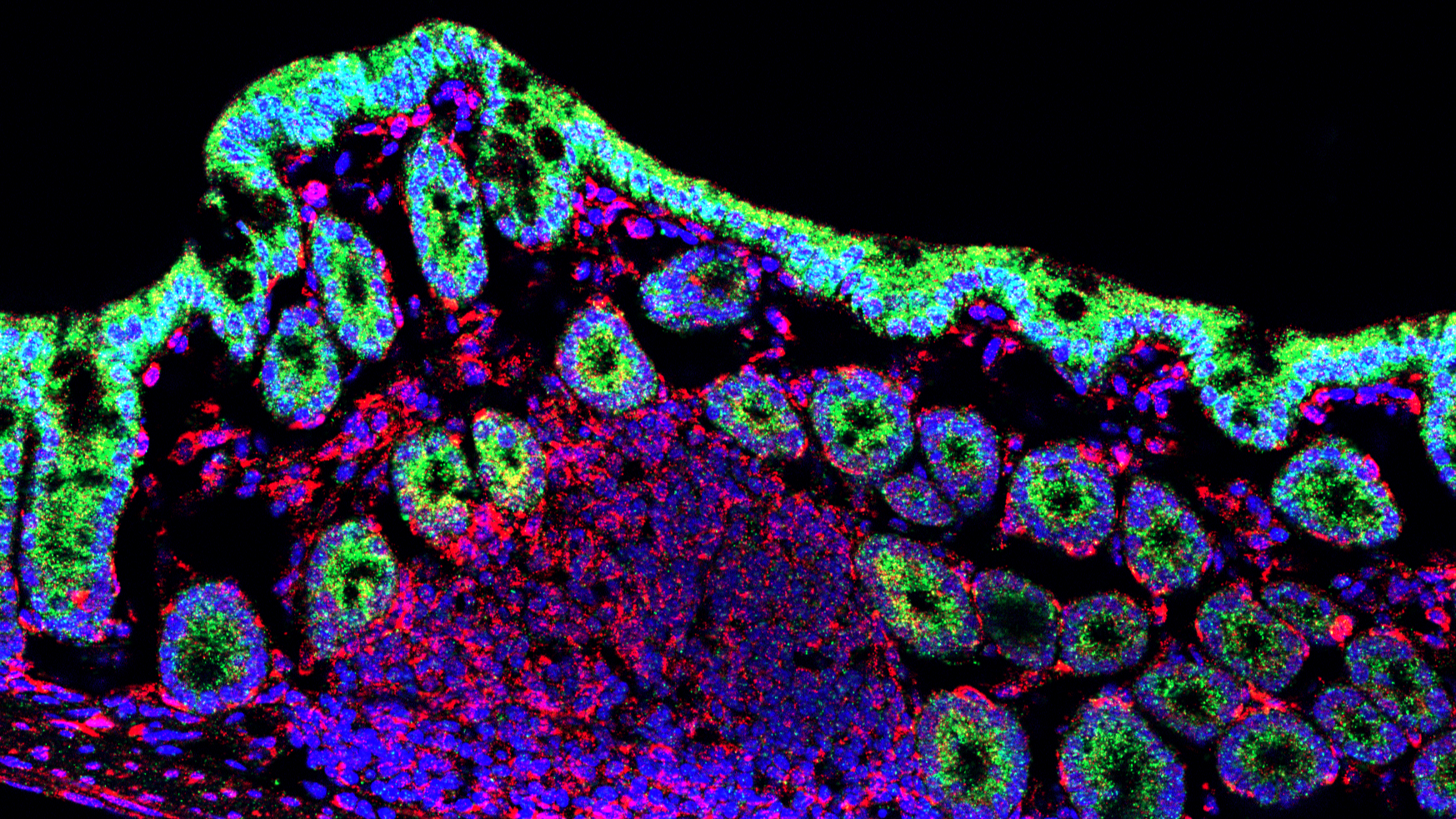 Biotech startup's microbiome gene expression data image