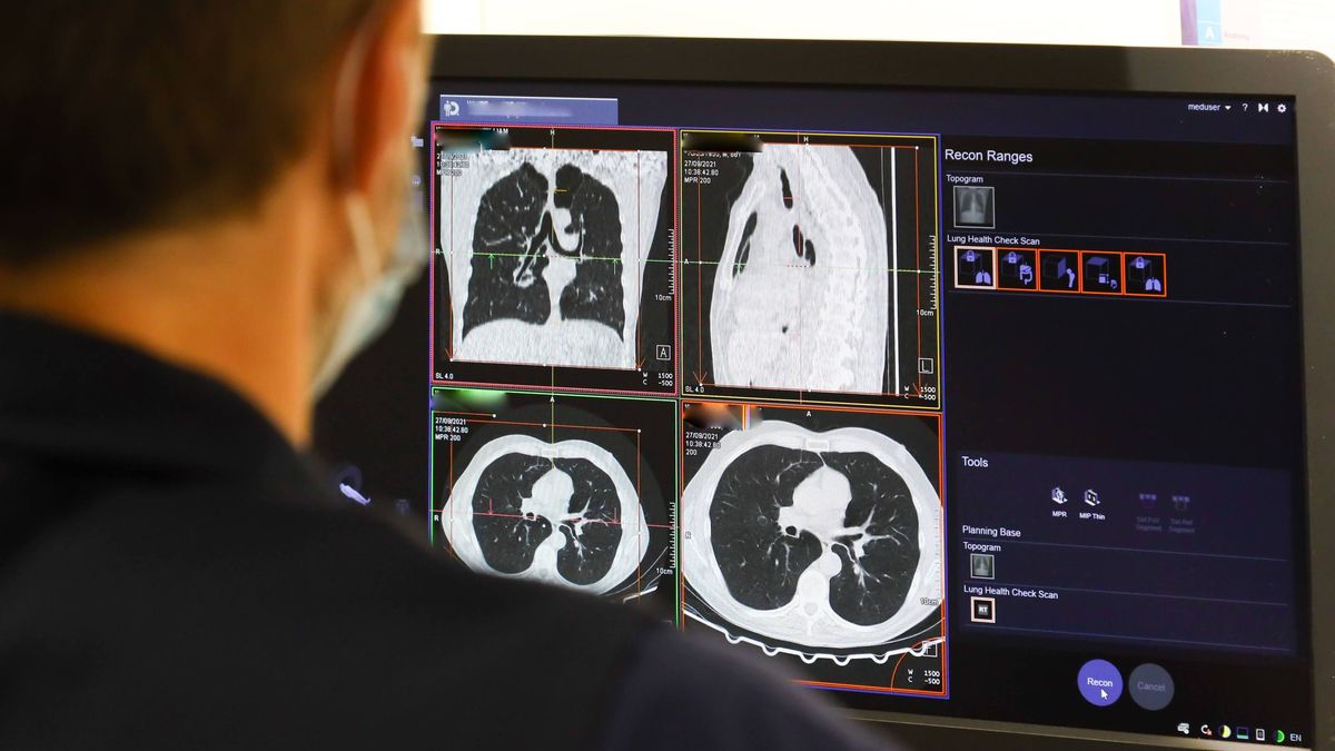 AI detecting pancreatic cancer years before doctors can see it on scan — NHS England study