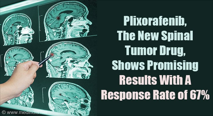 Plixorafenib receiving FDA Breakthrough Therapy Designation for spinal tumors