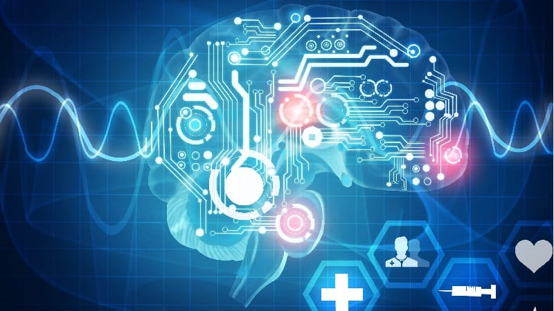 Brain waves illustration for AI diagnostics
