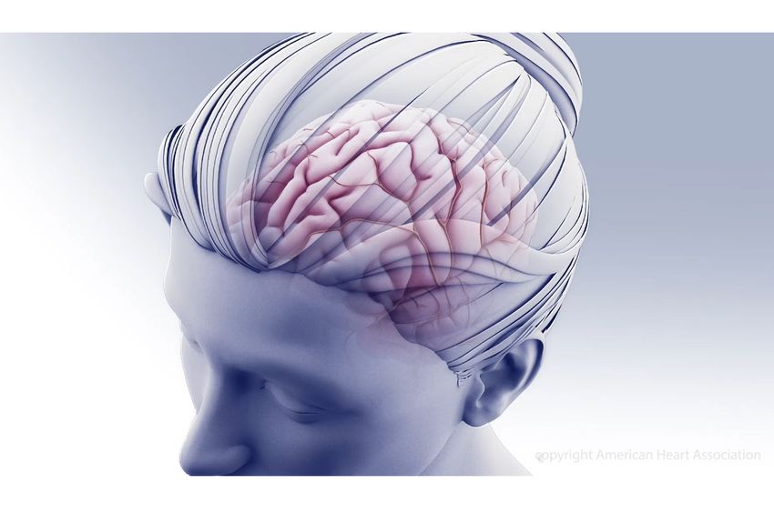 Head and brain illustration depicting lifetime brain health factors