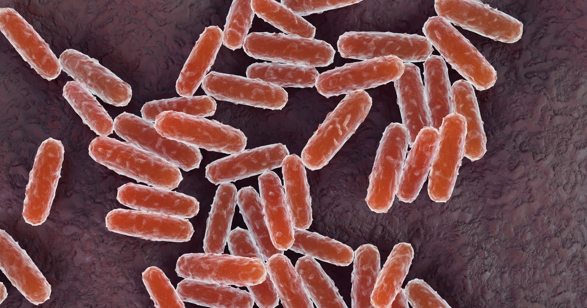 Microscope image of Yersinia pestis bacteria