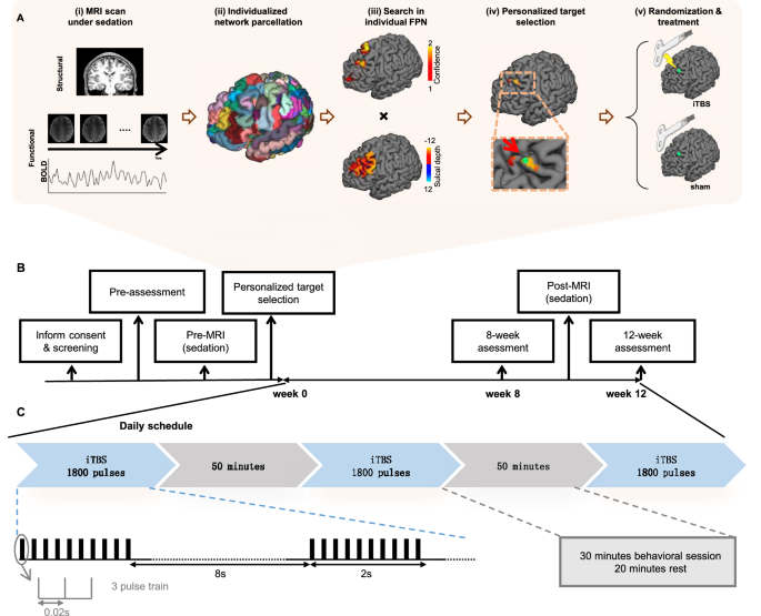 Overview of the accelerated intermittent theta-burst stimulation protocol (Fig.1)