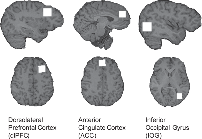 Gut bacteria linked to key brain chemicals