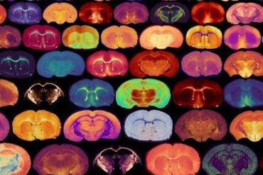 Brain slices illustrating myelin and glucose signaling