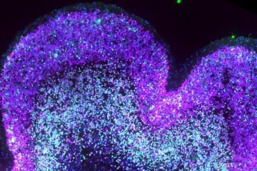 Neurons in the developing neocortex in Down syndrome context