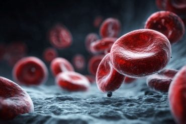 Blood plasma related to TBI freeze-dried platelet treatment