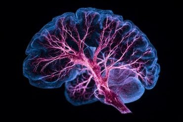 Brain scan illustrating metabolic pathways in bipolar disorder