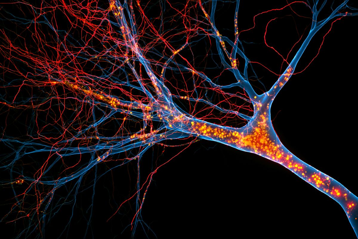 Brain imaging showing iron accumulation in neurodegeneration