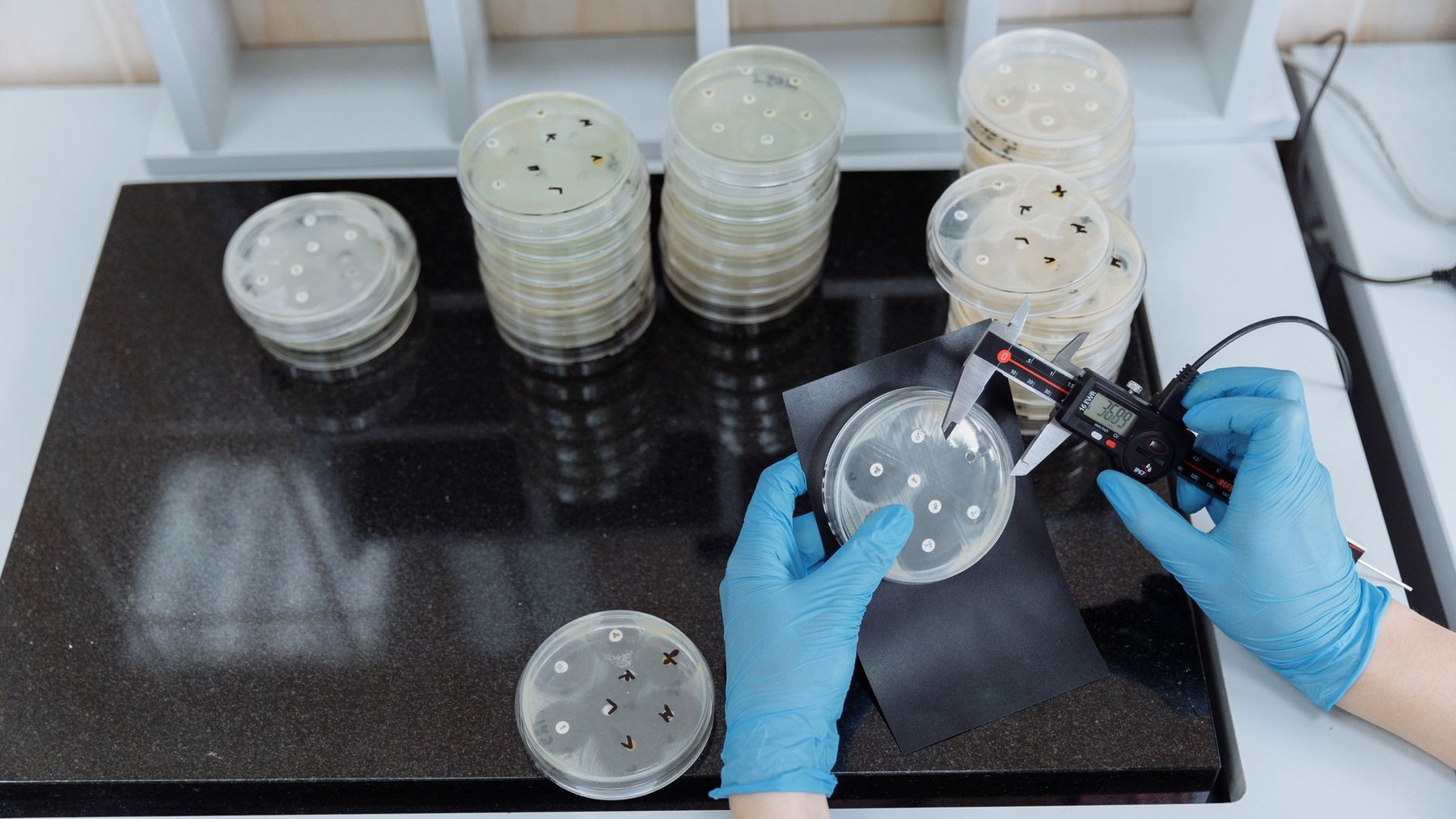 Visual data showing the genetic link between gut microbes and cognitive function found in the 2026 study