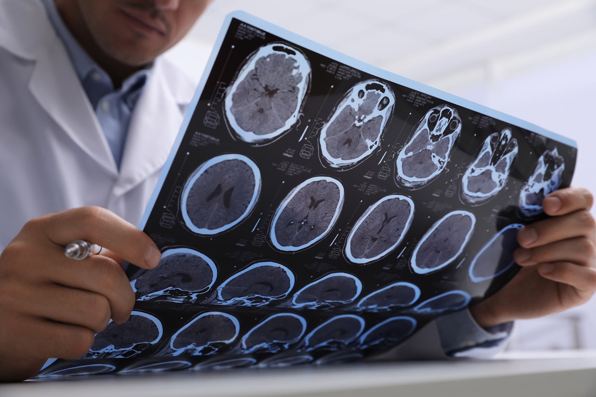 Doctor examining MRI brain scans, illustrating the new metamaterial MRI antenna breakthrough