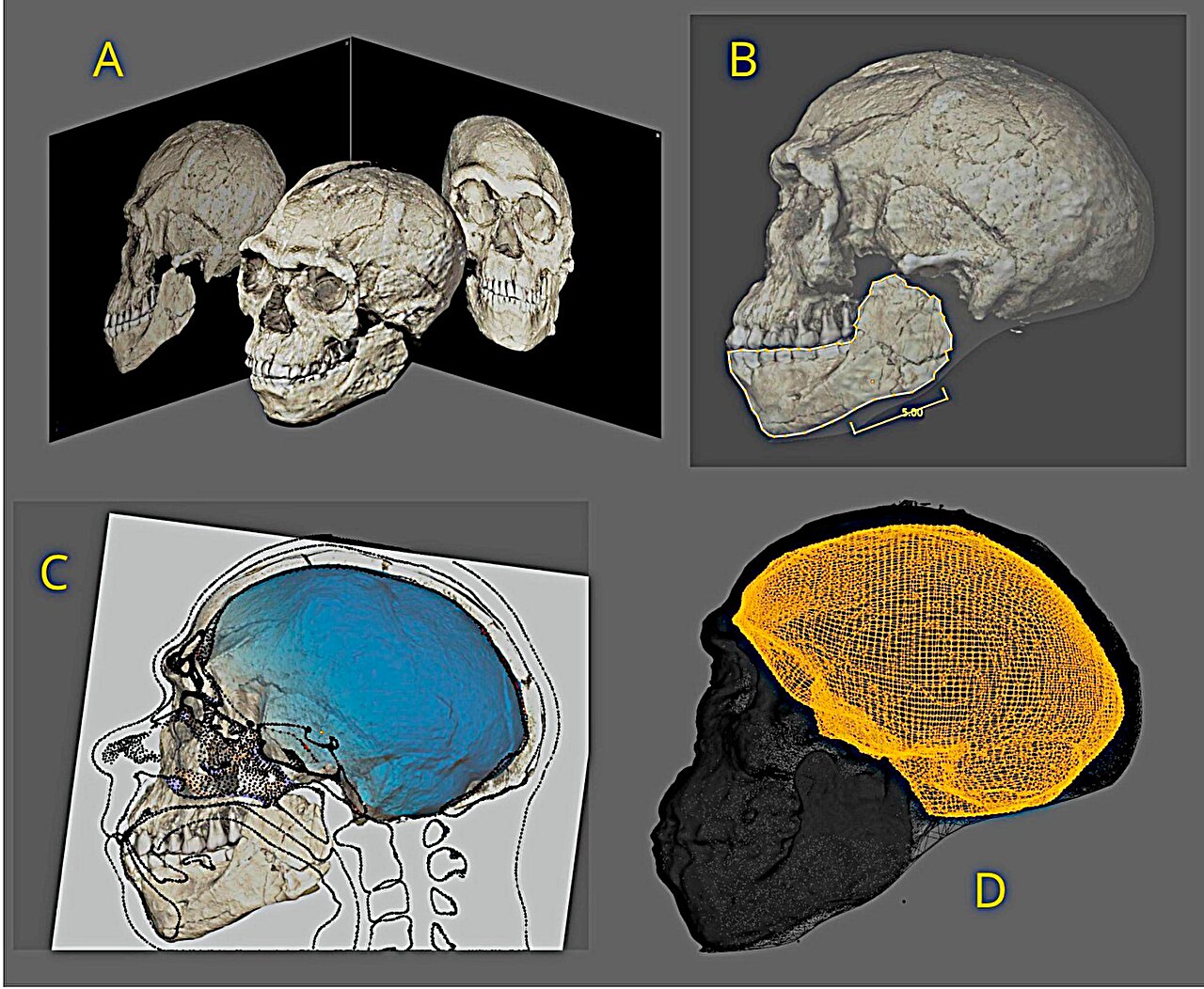 Pieced-together Moroccan skull showing early human facial reconstruction
