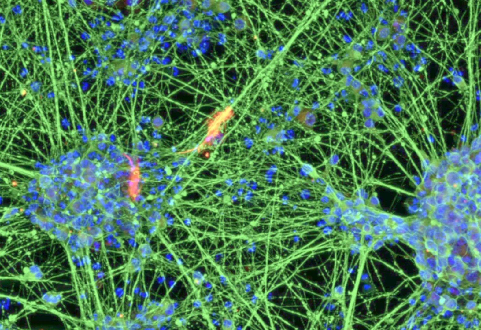 German media highlight Bonn researchers' success in rejuvenating blood cells by decades