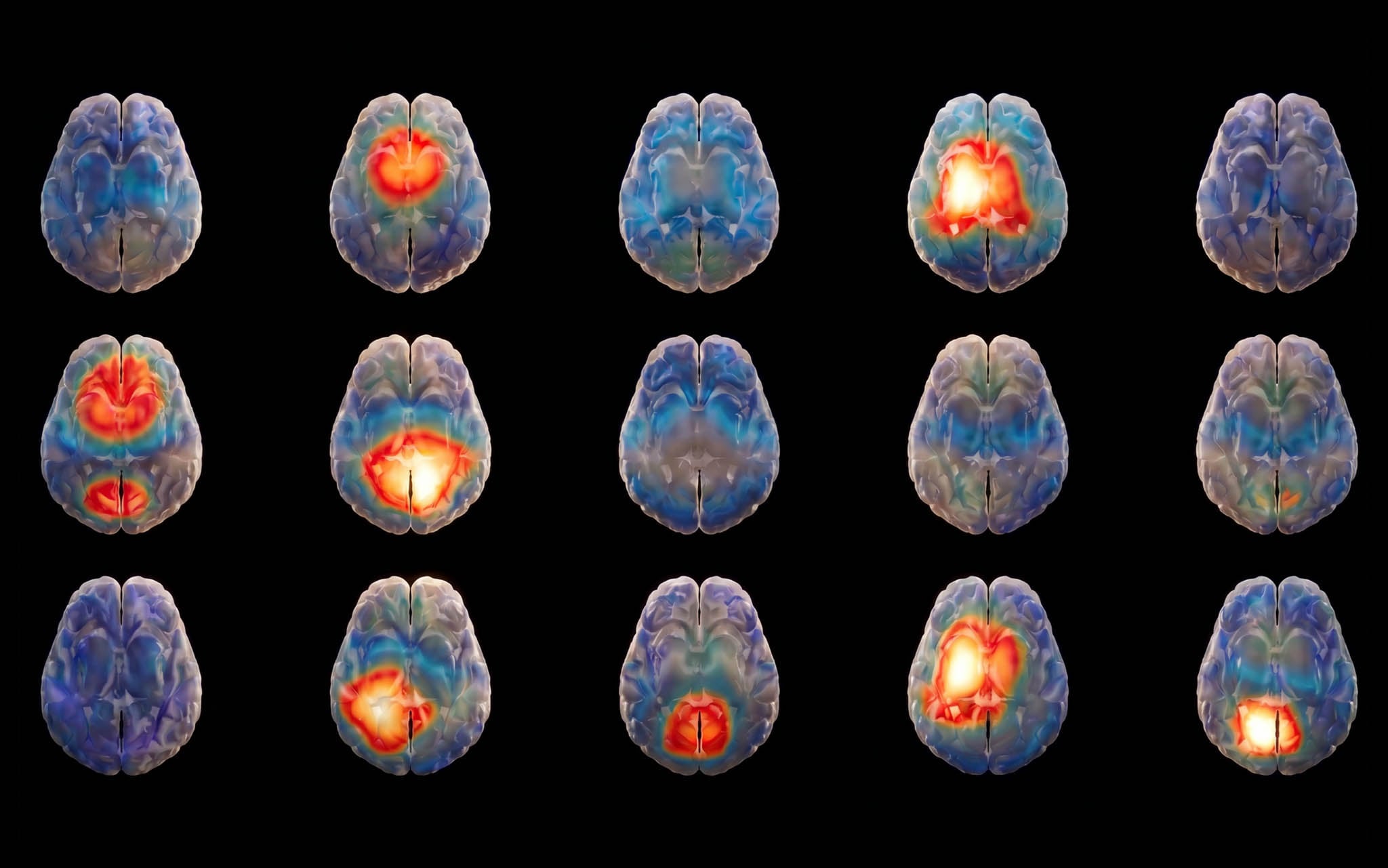 EEG brain-wave data visualization associated with AI-based brain-signal analysis