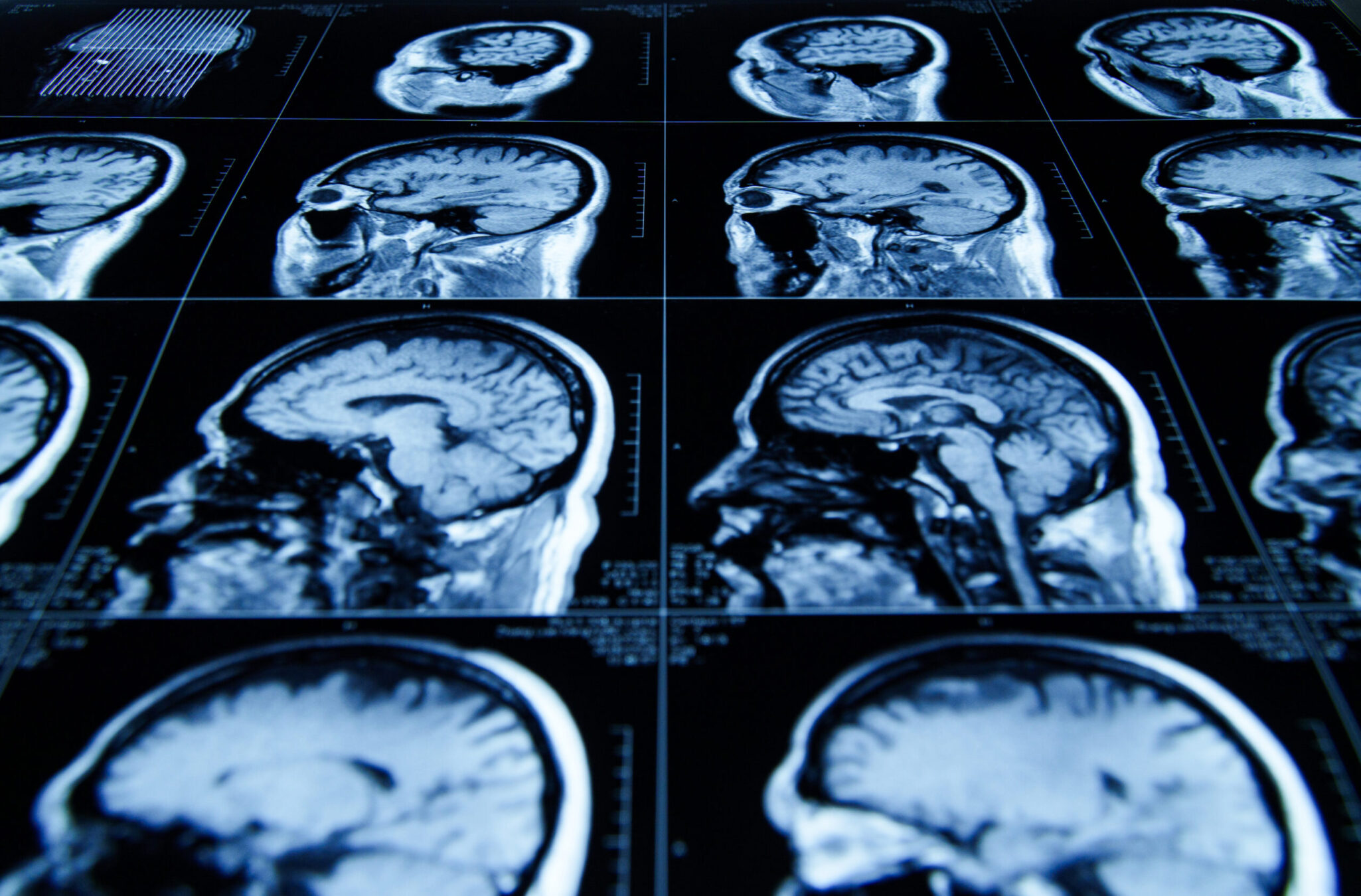 Image of brain injury treatment experiments at Texas A&M
