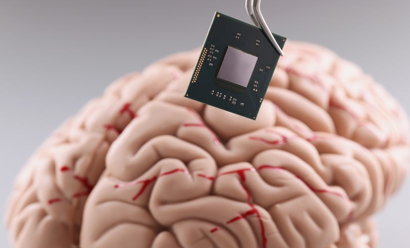 Visual representation of brain-computer interface restoring voice and movement