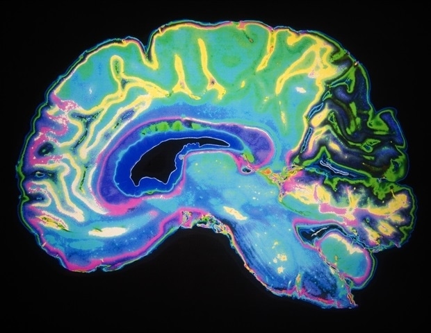 Artificially Colored MRI Scan Of Human Brain