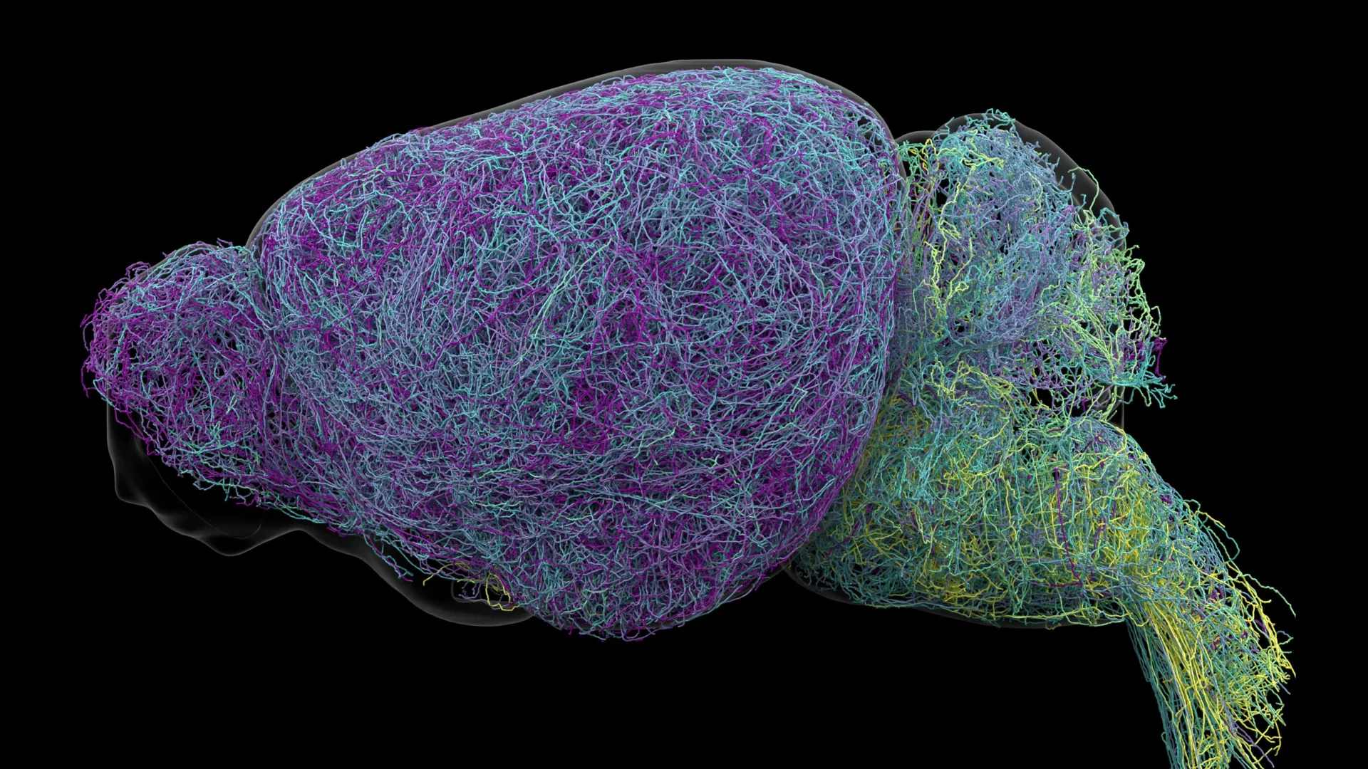 Reconstruction of a 100-lc neuron