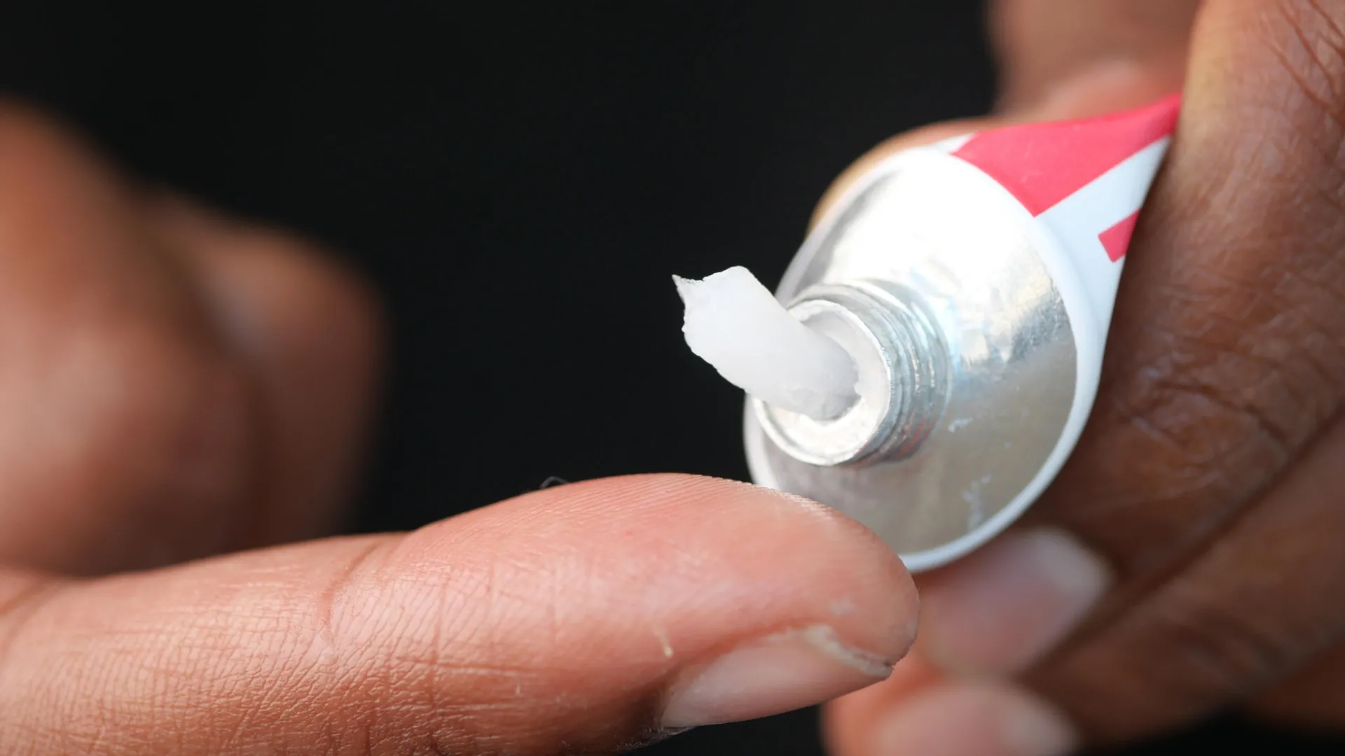 Applying a topical cream or ointment to skin — illustrating the delivery mechanism for the ABT-263 senolytic wound-healing study