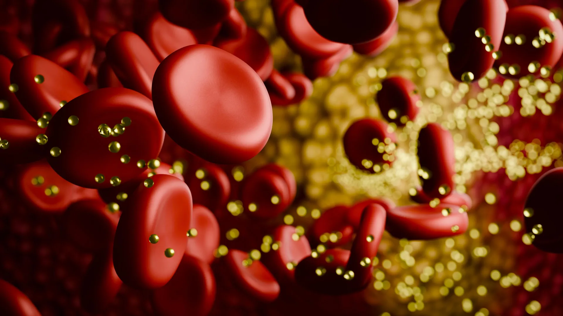Illustration of cholesterol plaque in a bloodstream, related to the CRISPR lipid disorder trial