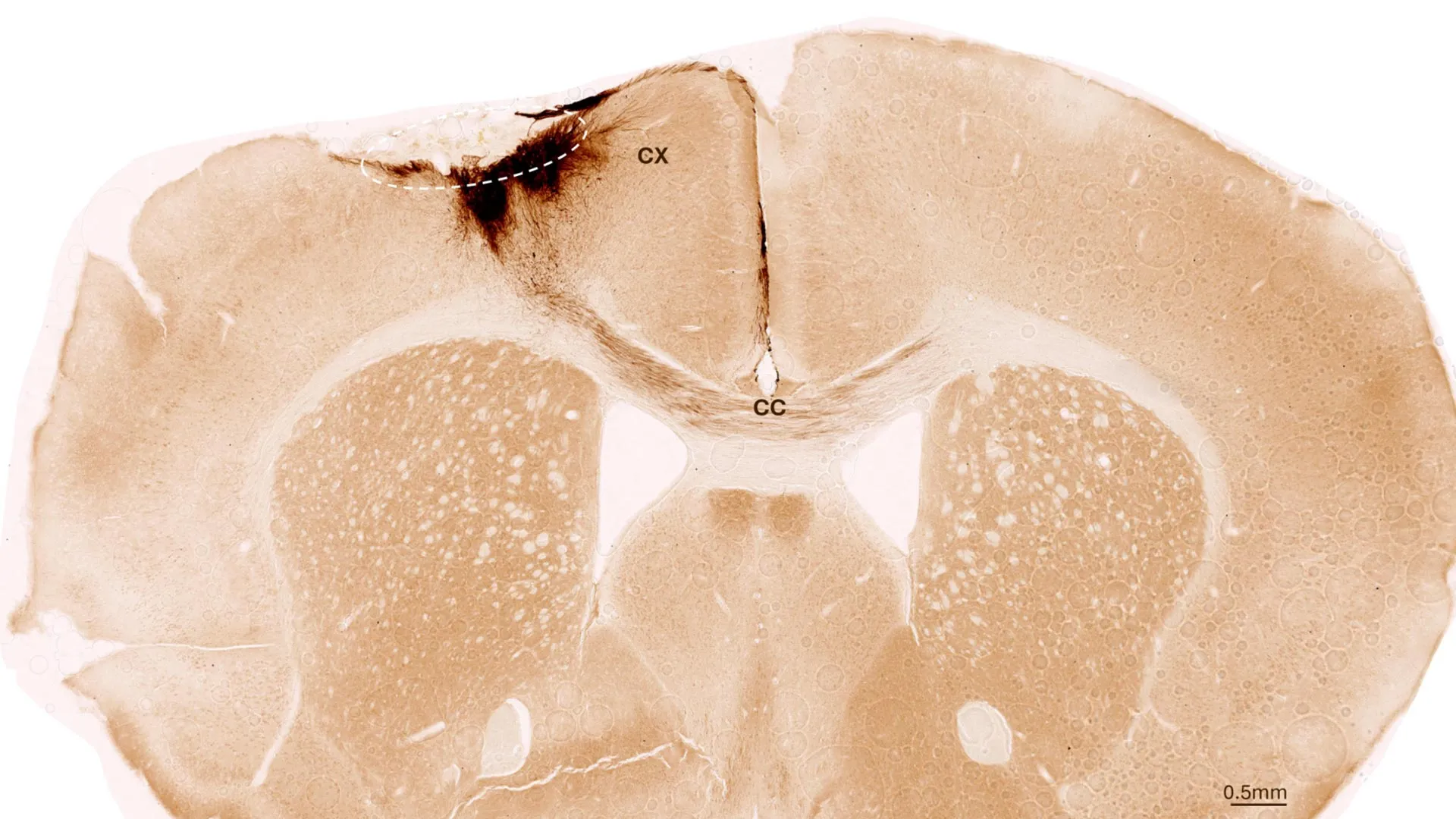 Mouse brain after stroke and neural stem cell transplantation