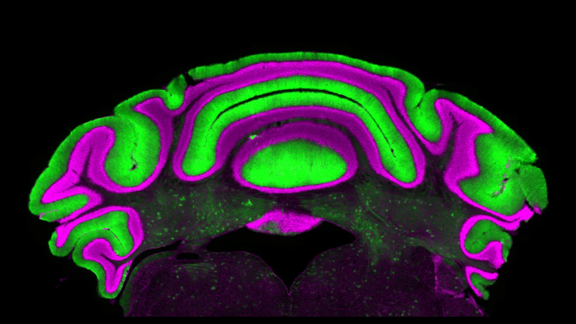 Purkinje cells in the cerebellum showing complex neural activity patterns during movement control