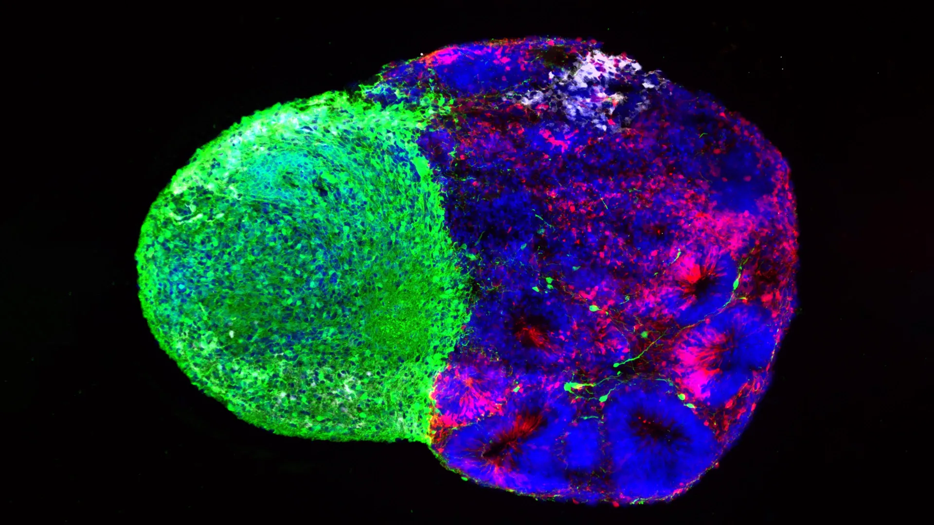 Thalamic and cortical organoids illustrating brain development