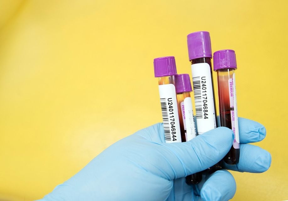 Blood sample collection for aging research
